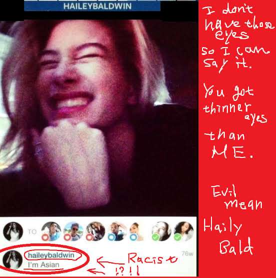 ジャスティン・ビーバーの妻、“心臓手術”成功に感謝