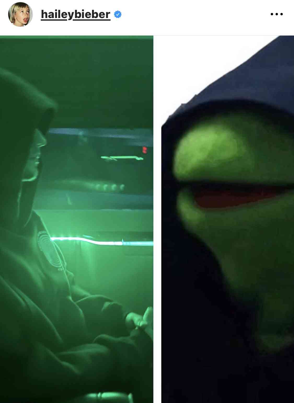 ジャスティン・ビーバーの妻、“心臓手術”成功に感謝