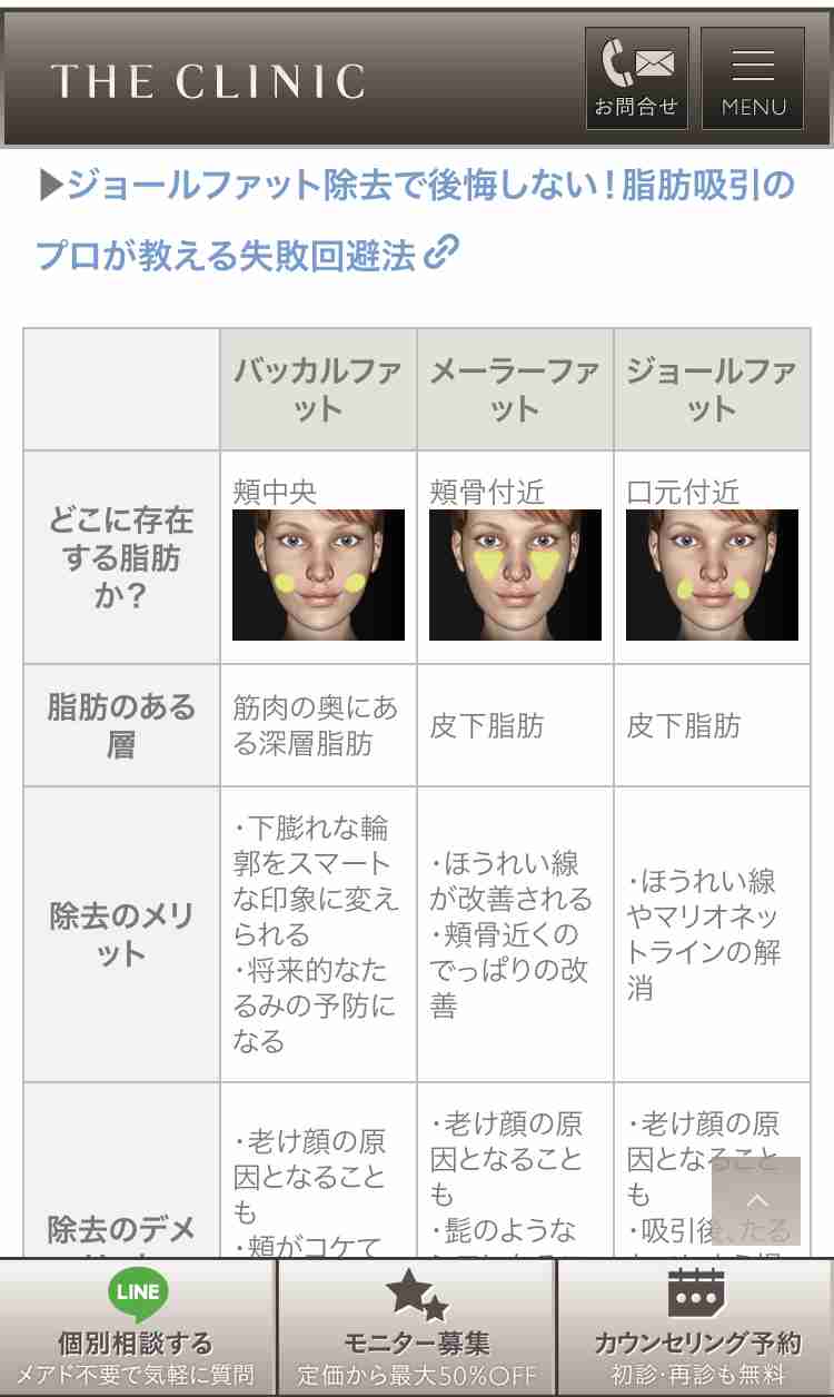 美容整形でパスポートの顔写真と違いすぎる旅行者、空港の出国審査で足止めされる(豪)