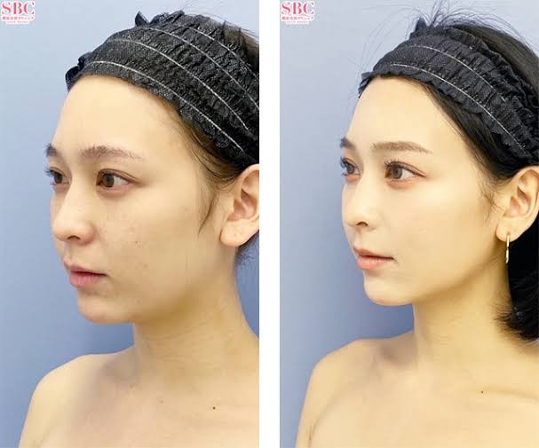 「整形したい」と言い出した中1の娘に何と言うべき？塾経営の笑い飯・哲夫の意外な答え