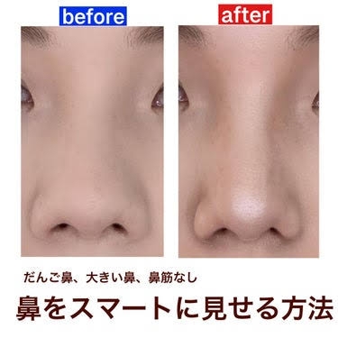 「整形したい」と言い出した中1の娘に何と言うべき？塾経営の笑い飯・哲夫の意外な答え