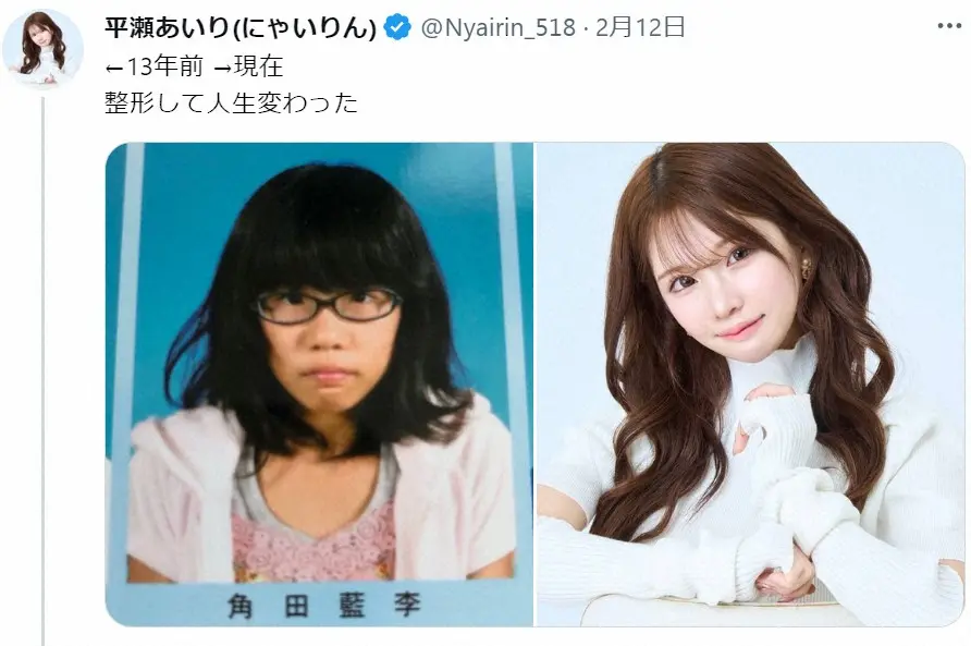 「お母さんが1日2日帰ってこない」「自分に包丁を突きつけた」整形総額1000万円越えのインフルエンサー・平瀬あいり、壮絶な過去を告白