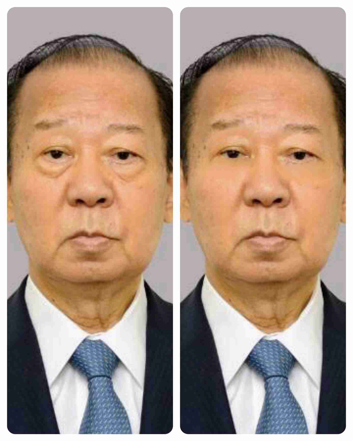 涙袋入れた事ある人ー!