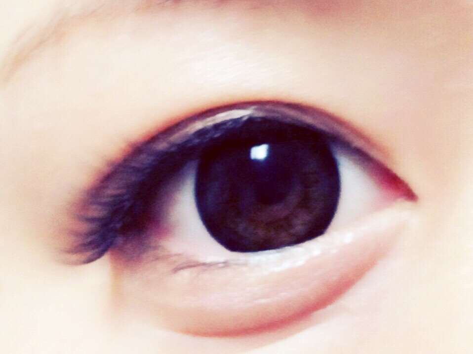 涙袋入れた事ある人ー!