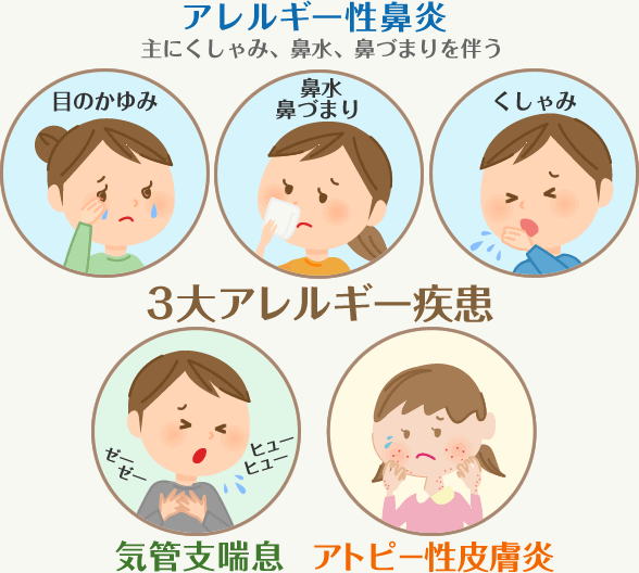 お子さんがアレルギーの方お話しませんか