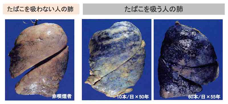 喫煙&飲酒してても長生きな人周りにいますか?