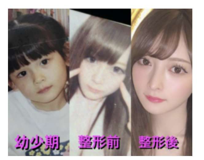 タトゥー「ない方が子供には良い」「実際あったらみんな距離取る」 双子母整形インフルエンサーが除去報告