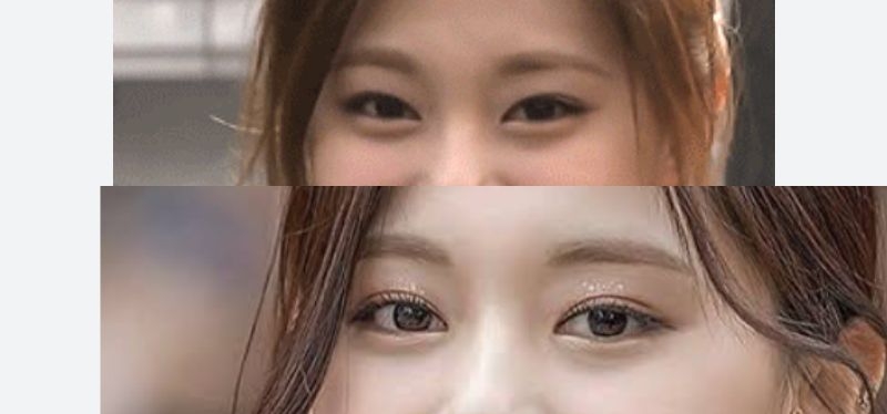 整形1350万アイドルに「子供産んだ時が楽しみだね！笑」　容姿めぐり壮絶中傷…「これが私の日常だった」