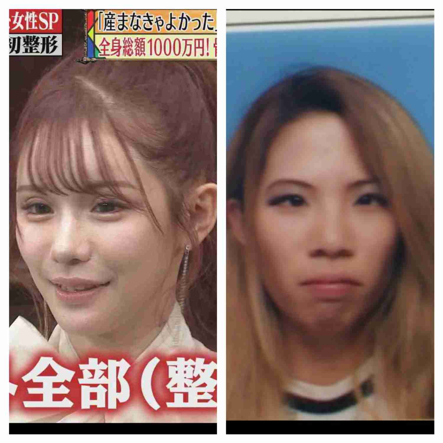 1千万整形のインフルエンサー　悲惨告白、アプリで会った男性がビフォー見て引く「整形ヤバい」→嘘ついて帰りブロック