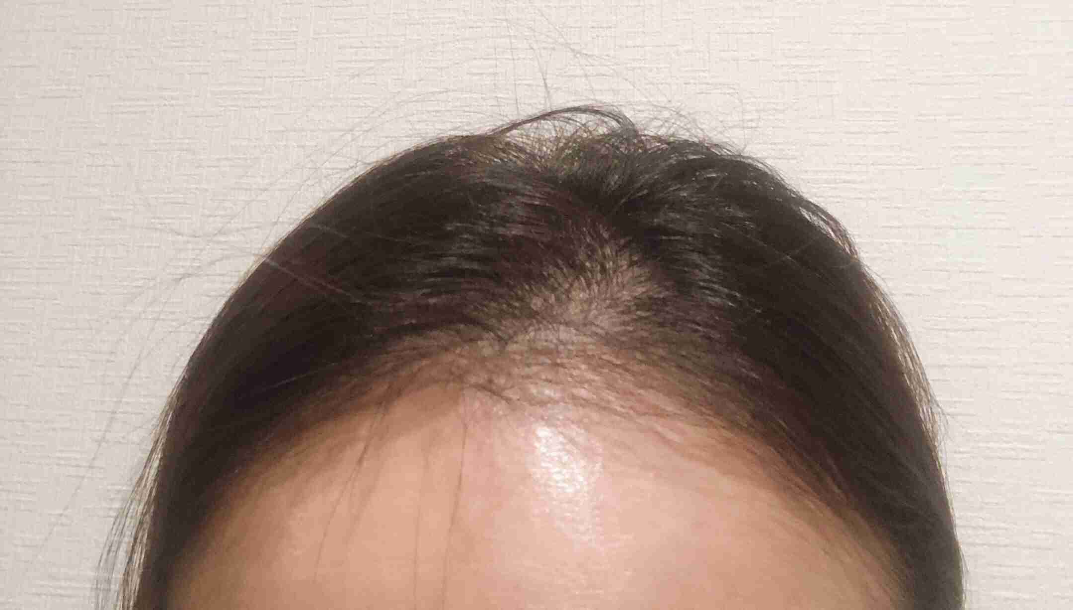 毛量が無さすぎる