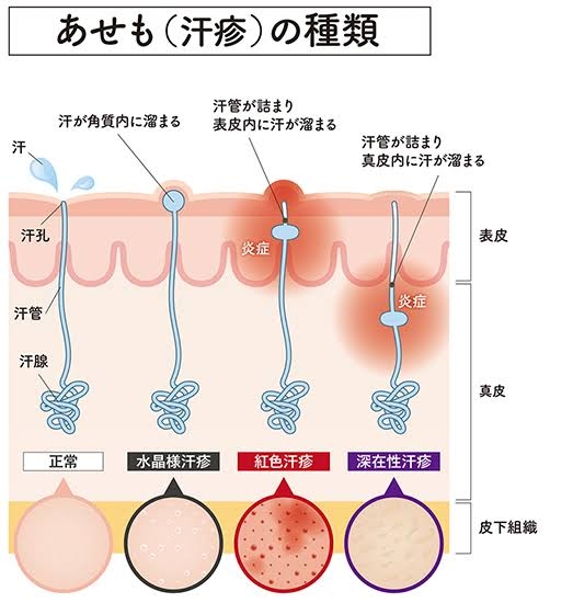 「理想の夏」と「現実の夏」の画像