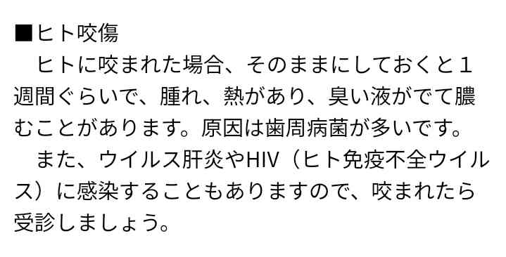 「暑くてやってしまった」女逮捕　アイス盗み店員の手にかみつく