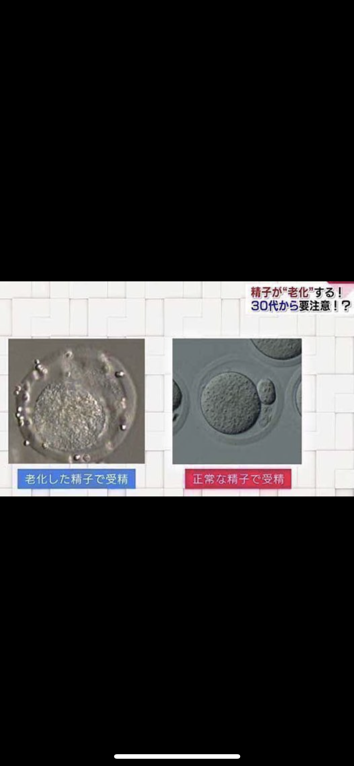 卵子凍結は日本の少子化を止める切り札になるか？賛否ある「社会的卵子凍結」の実態