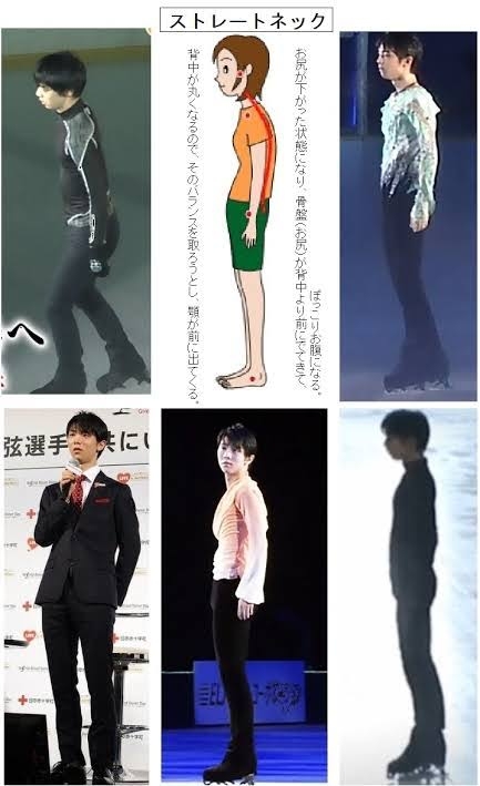 ストレートネックの治し方