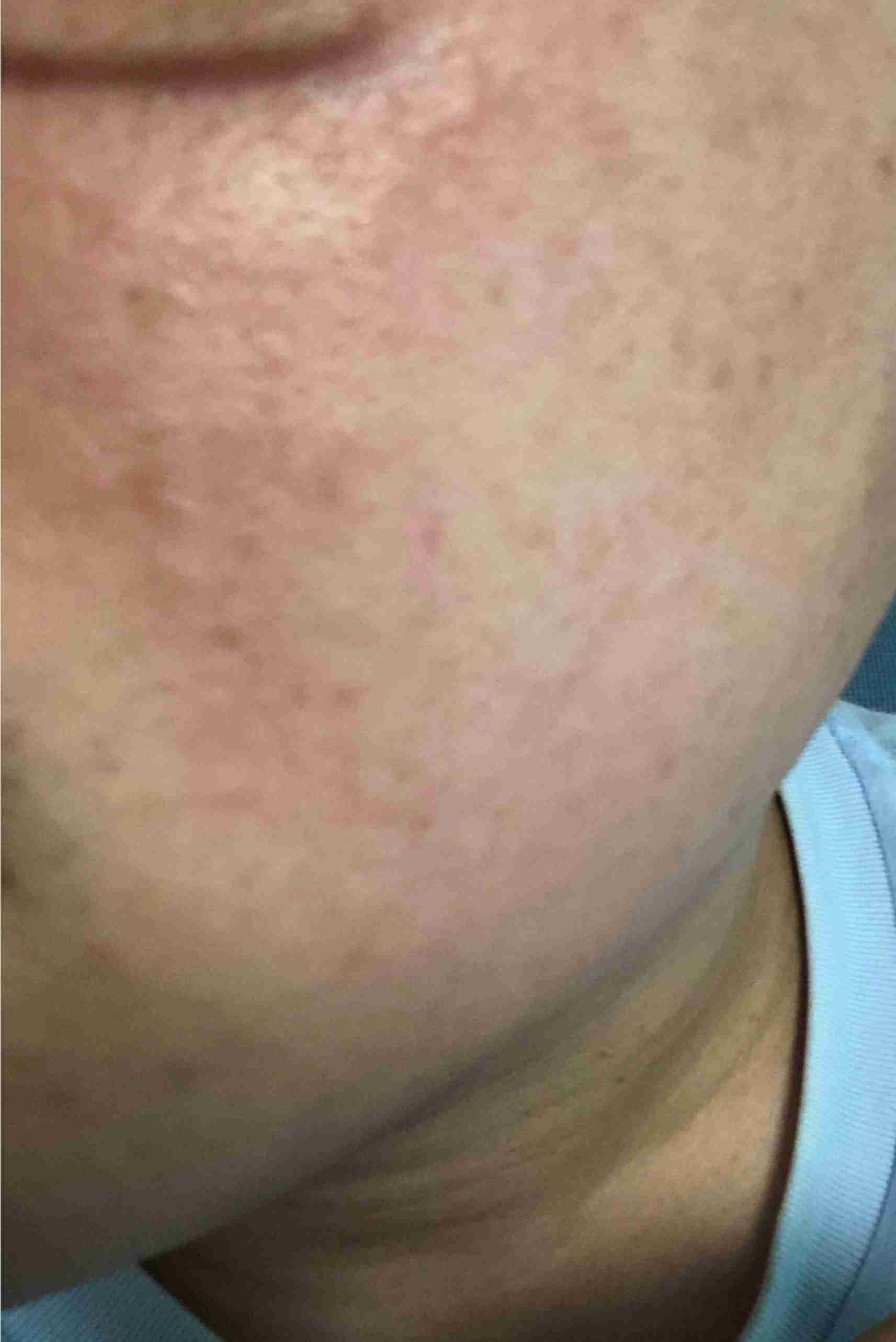 美容皮膚科の効果