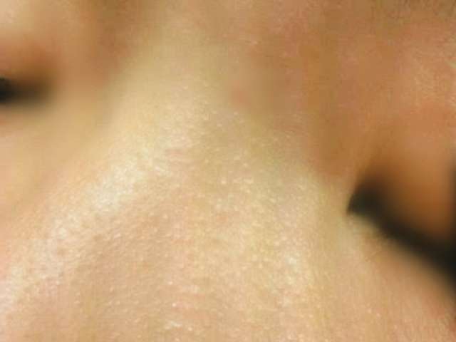 美容皮膚科の効果