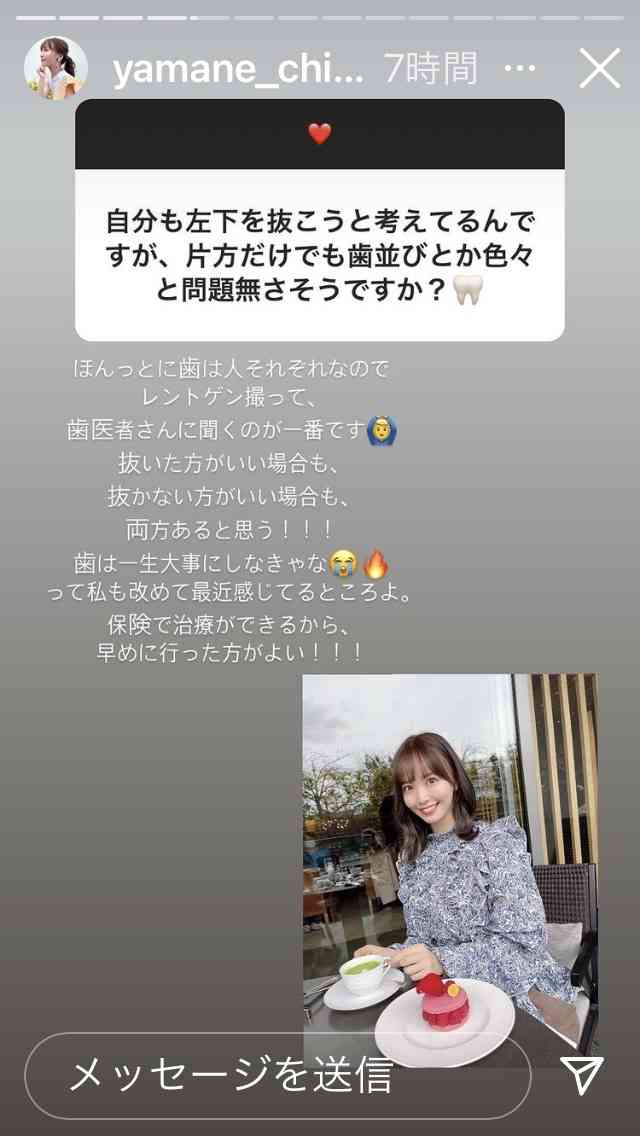 NGT48・中井りか「責任感のかけらもない」グループの衣装スタッフに激怒 紛失や手配遅れのトラブルに