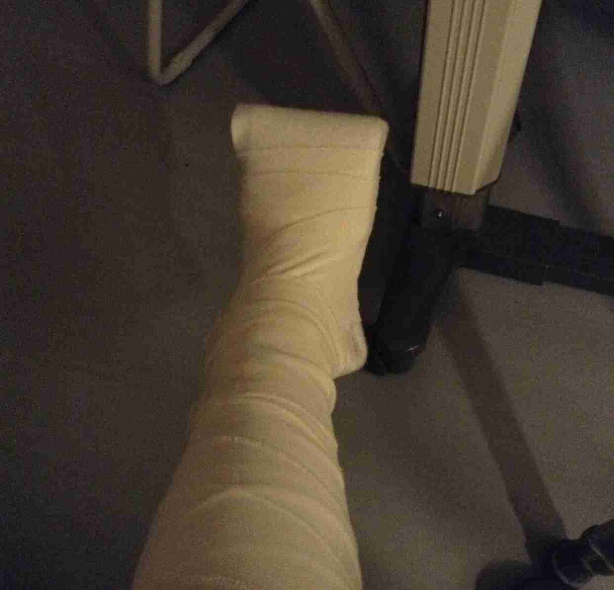 骨折経験聞きたいです