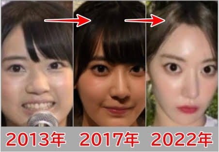 「整形前より醜くなった」と自信喪失…二重まぶたの手術を3回繰り返した女子大学生は身体醜形症になった