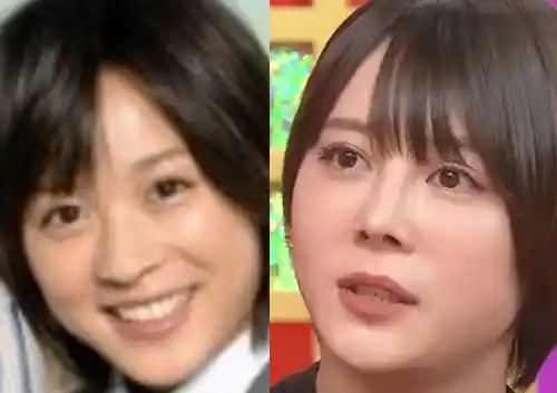 「整形前より醜くなった」と自信喪失…二重まぶたの手術を3回繰り返した女子大学生は身体醜形症になった