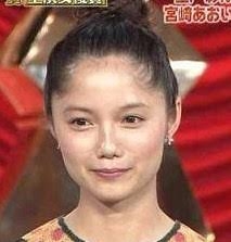 「整形前より醜くなった」と自信喪失…二重まぶたの手術を3回繰り返した女子大学生は身体醜形症になった