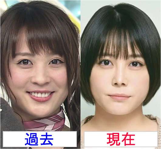 「整形前より醜くなった」と自信喪失…二重まぶたの手術を3回繰り返した女子大学生は身体醜形症になった