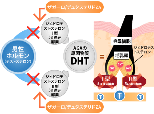 旦那さんや息子さんが薄毛治療している方いますか？