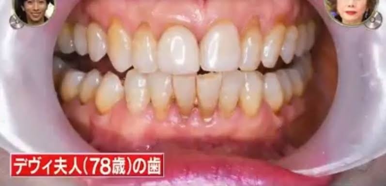 83歳・デヴィ夫人、28本すべて自分の歯「奇跡と言われた」 家に歯ブラシ20本常備&1日5回歯磨き