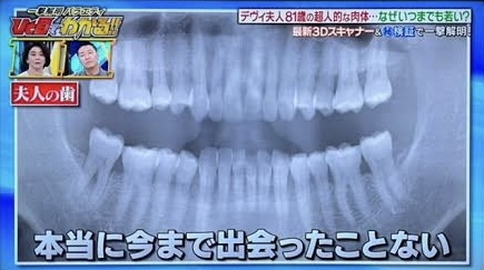 83歳・デヴィ夫人、28本すべて自分の歯「奇跡と言われた」 家に歯ブラシ20本常備&1日5回歯磨き