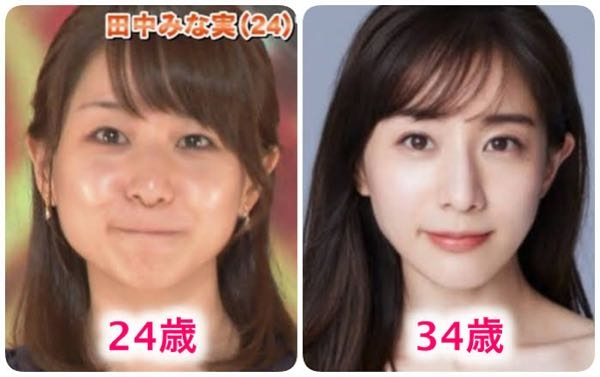 田中みな実「手が黄色くなってきた」　美を保つため…ビタミンCを4時間に1回摂取