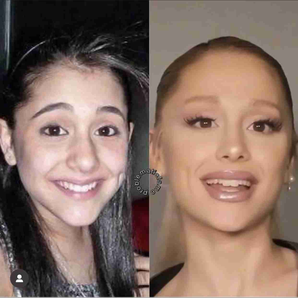 アリアナ・グランデ、“5年前までの美容施術”さらけ出して涙　「やりすぎだって感じた」「ただ隠したかった」