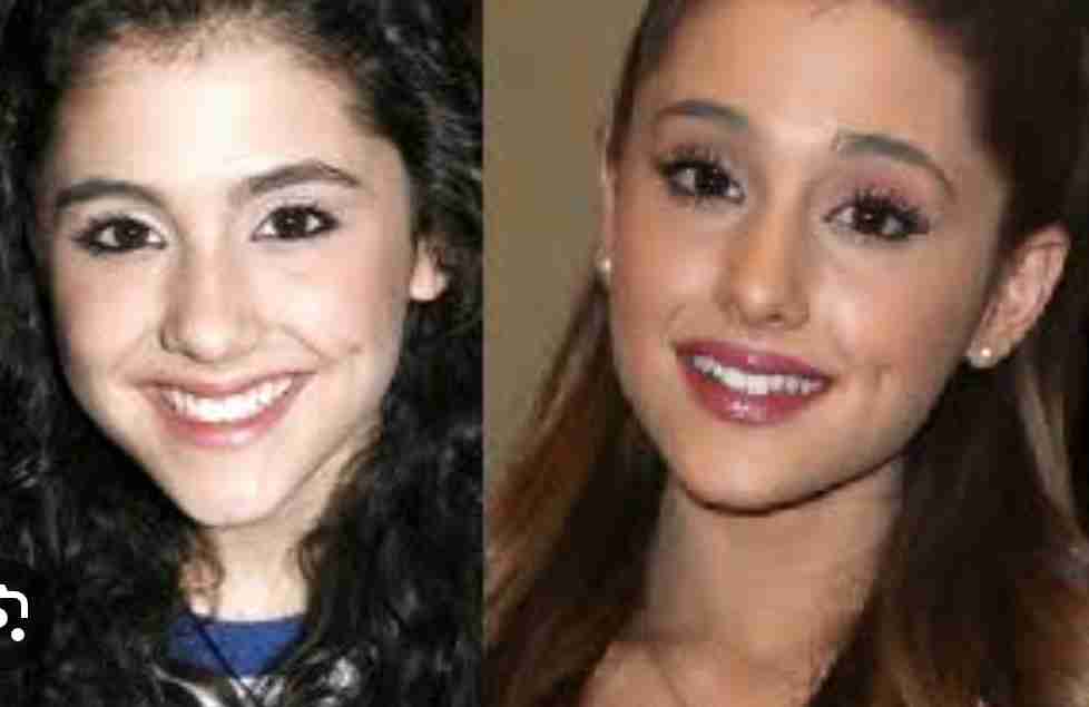 アリアナ・グランデ、“5年前までの美容施術”さらけ出して涙　「やりすぎだって感じた」「ただ隠したかった」