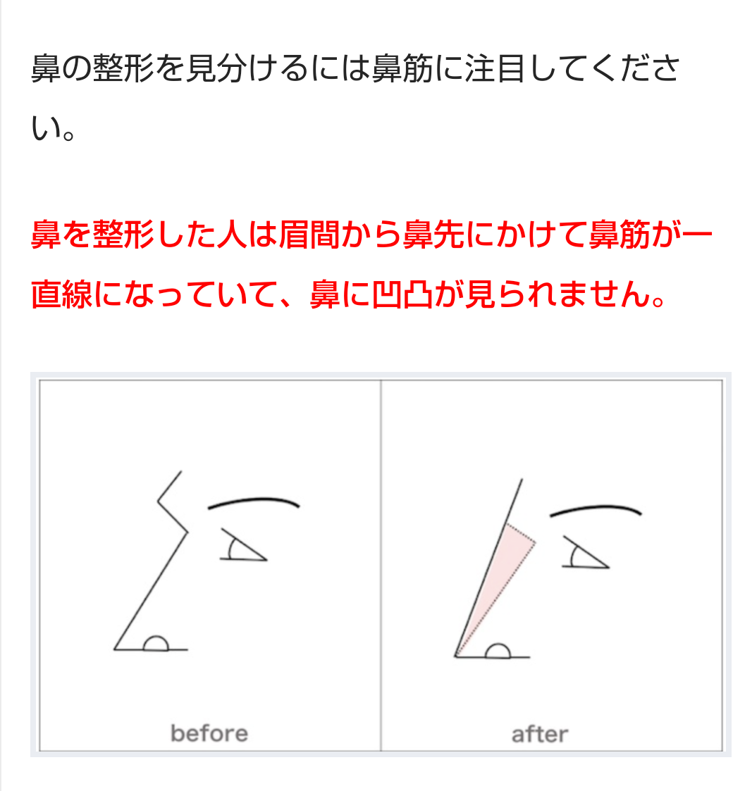 3回二重整形した女性が“一重に戻した”ワケ「他人の価値観で自分を傷つけていたのが本当に馬鹿らしくなった」