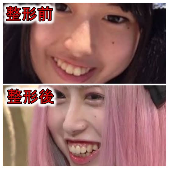整形総額800万円アイドル、驚きの全財産を告白「まじでただの生活の危機」で仕事を急募