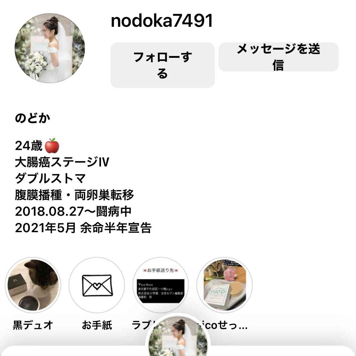 日本人に最も多い大腸がん、悪化させる体内物質を特定…京都大などの研究チーム