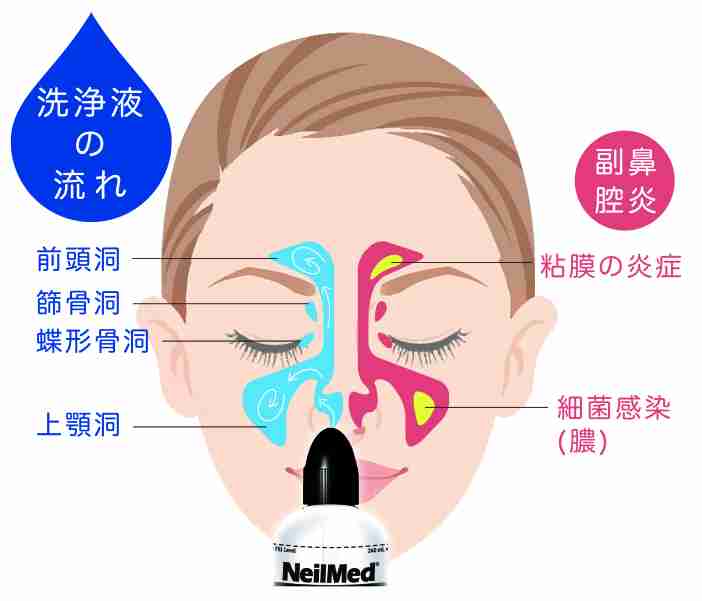 鼻うがい、やっている人～