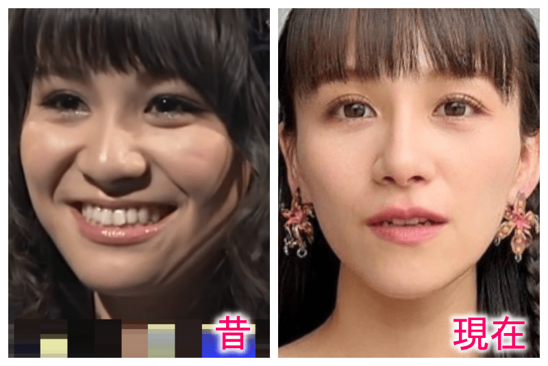 「鬼ダイエット」Perfumeあ~ちゃん横向き姿が衝撃!バッグでウエストが見えない ファン「何事も適度に」