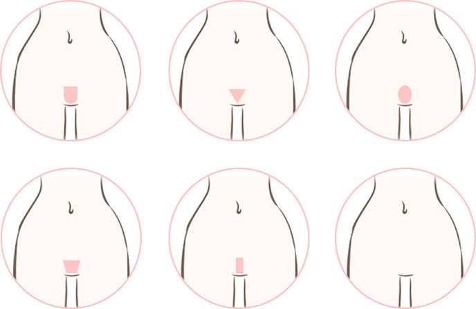 現在脱毛サロンor医療脱毛に通ってる方