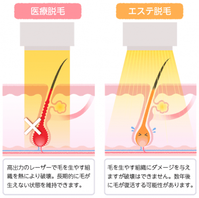 現在脱毛サロンor医療脱毛に通ってる方