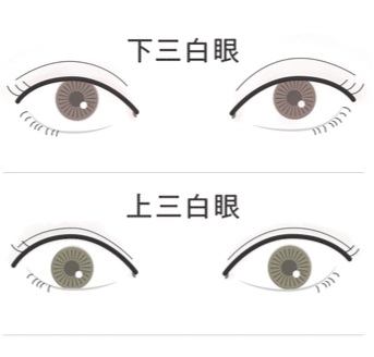 カラコンを辞めれた人(三白眼)