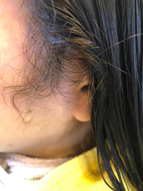 もみあげが気になる
