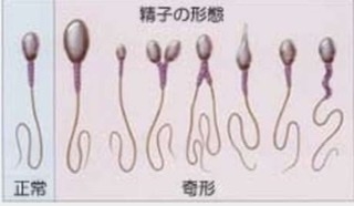 【旦那の加齢臭】