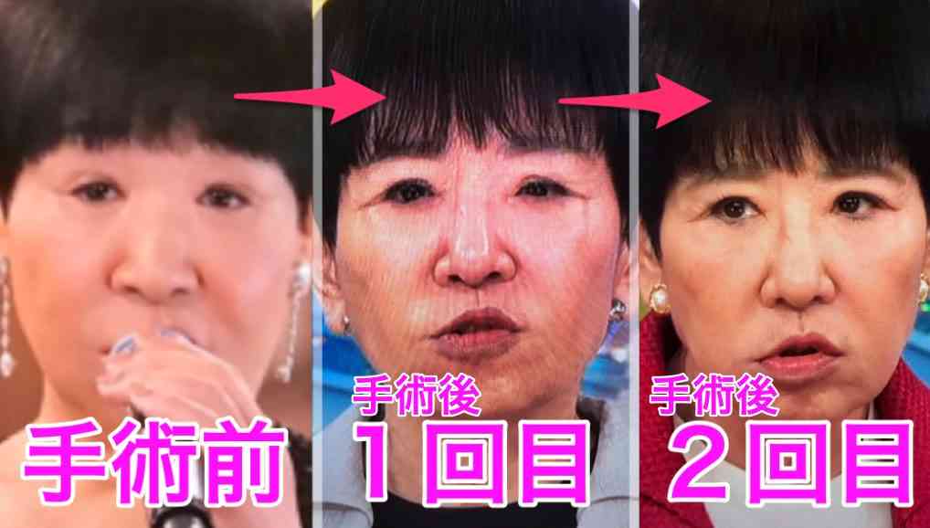 和田アキ子も敗北　酒飲むと芸能界最恐の女優を暴露　アッコも「帰って」とお願い　竹山「一番恐ろしい」