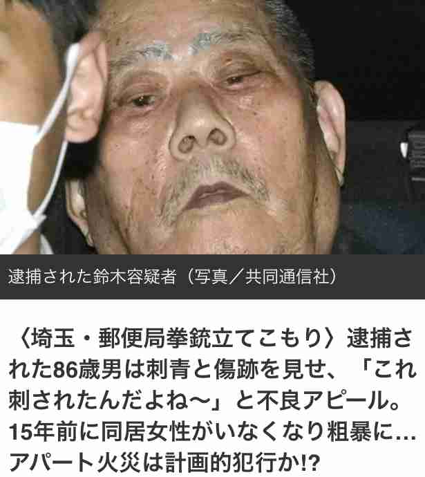 医師に殺虫剤かけた疑い、86歳を逮捕 診察室で無言のまま 茨城