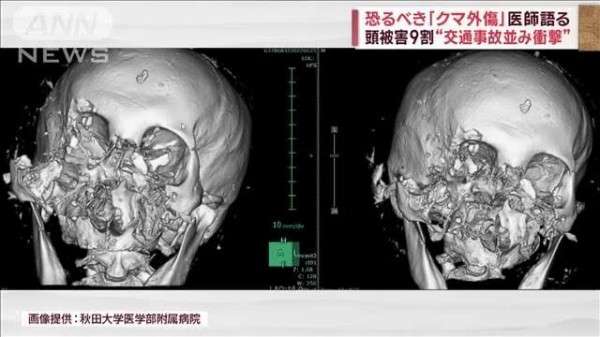 クマを「指定管理鳥獣」に　国に緊急要望　過去最多のクマによる人身被害受け　秋田県