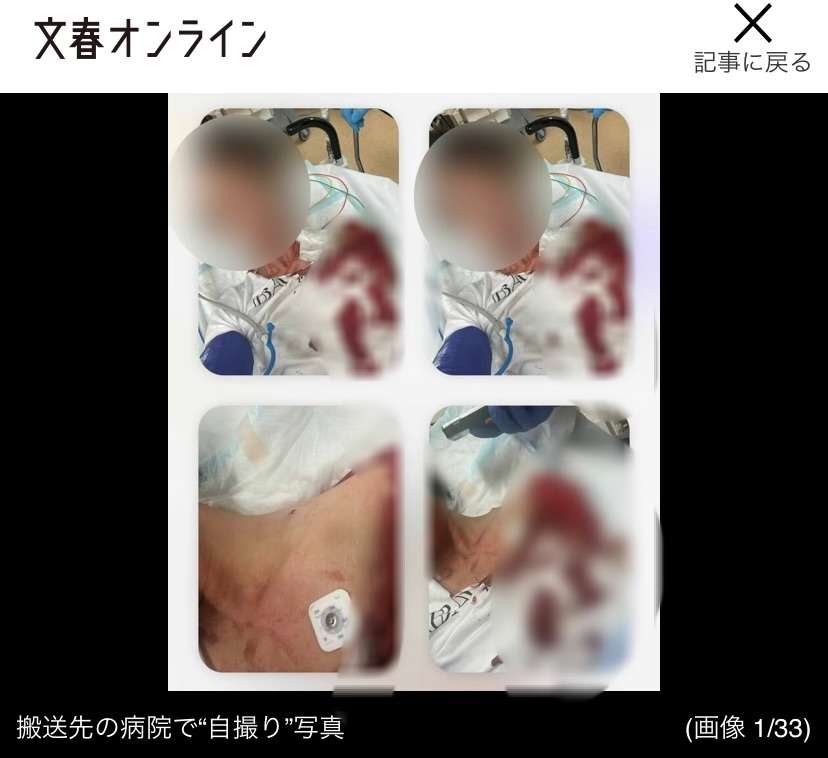 「肋骨骨折、顔面を8針縫い、尿管と膀胱を損傷…」《歌舞伎町ホスト殺人未遂事件》逮捕の女(25)が語っていた“男の壮絶DV”と“復讐予告電話”「なんでこいつ普通に生きてんの」