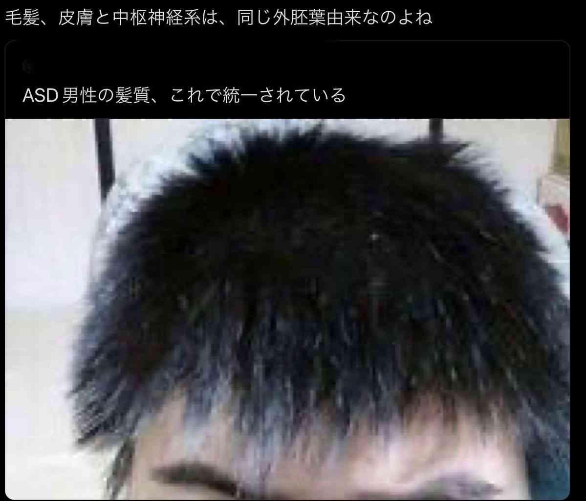 「私は奴隷」と悩む親も…自閉症児を育てた母が、わが子の「こだわり」に応じ続けた理由