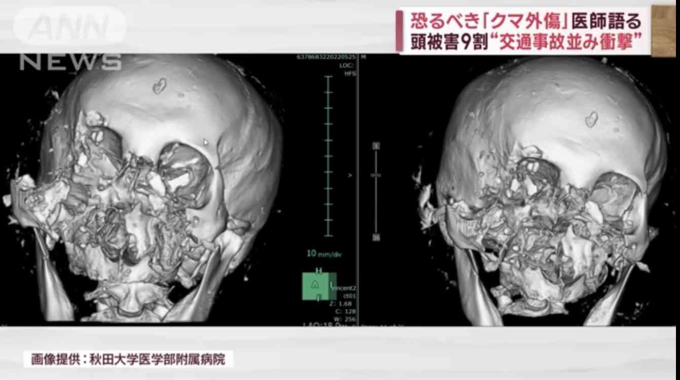 クマ捕獲で相次ぐバッシング　8道県知事、国に支援を緊急要望へ