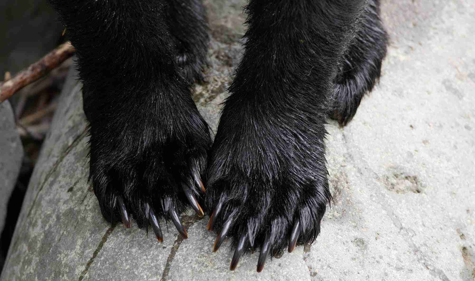 クマにひっかかれ、顔半分の皮がはがれ落ちる…被害の女性「鈴もスプレーも役に立たなかった」