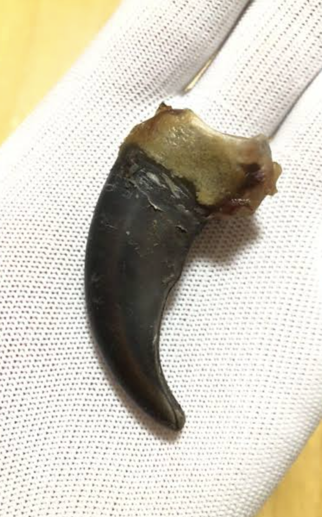 クマ駆除に「殺すな」と抗議　被害多数の東北、1日数件